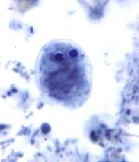 Dientamoeba Fragilis